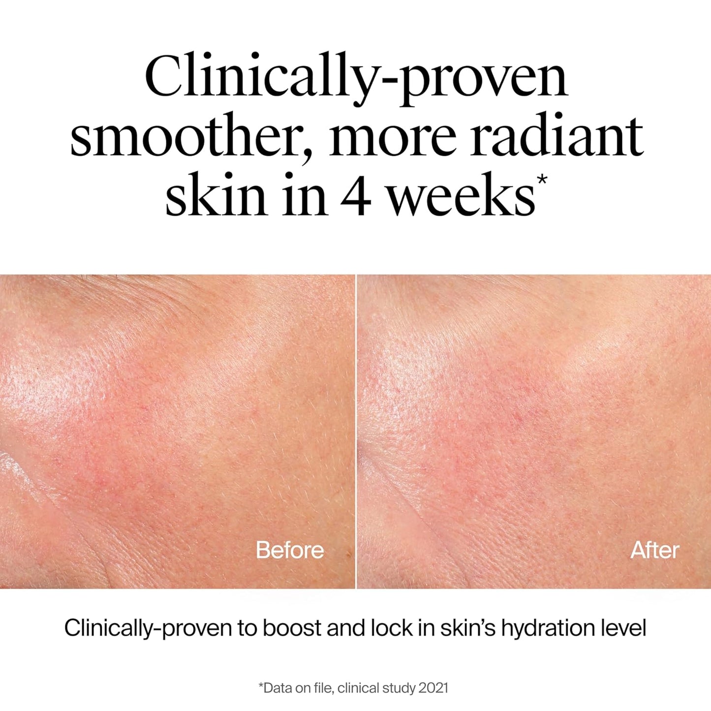 Hydro Boost Hydrating Face Wash & Makeup Remover, Gentle Facial Cleanser Gel with Hyaluronic Acid, Locks Moisture for Soft Supple Skin, Hypoallergenic, Oil-Free, Soap-Free, 7.8 Fl Oz